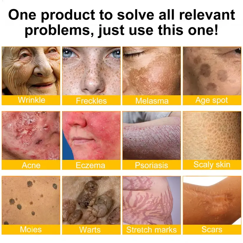 LOVILDS™ Skin Restoration Cream