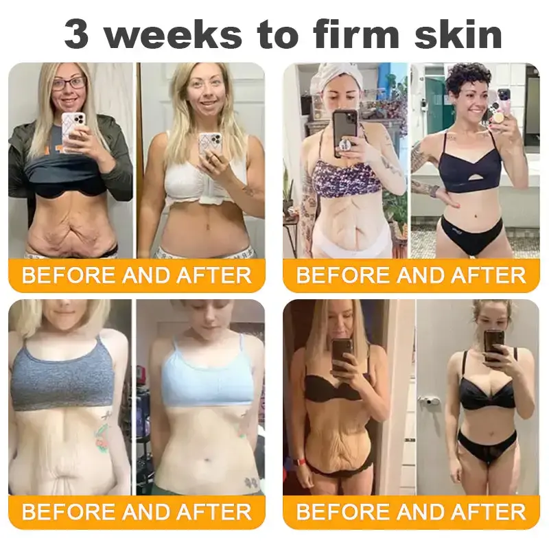 LOVILDS™ Skin Restoration Cream