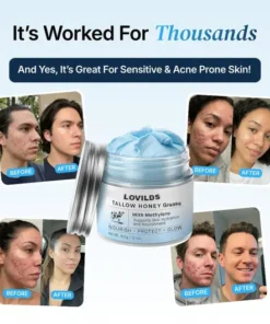 LOVILDS™ Tallow Honey Grease with Methylene - Naturally Hydrates to Restore Balance and Prevent Aging