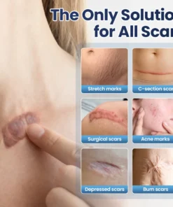 LOVILDS® Texture Repair Gel