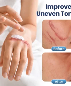 LOVILDS® Texture Repair Gel