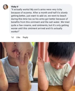 LOVILDS®The Steroid-Free Daily Cream for Eczema-Prone, Sensitive Skin