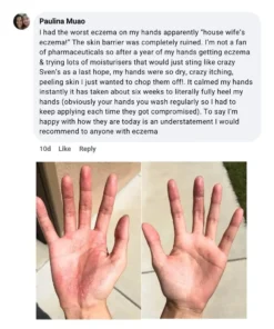 LOVILDS®The Steroid-Free Daily Cream for Eczema-Prone, Sensitive Skin