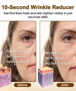 Lovilds® 10s Wrinkle Reducer