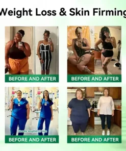 LOVILDS® 𝑴𝒐𝒓𝒊𝒏𝒈𝒂 𝑩𝒆𝒓𝒃𝒆𝒓𝒊𝒏𝒆 10-𝑰𝑵-1 𝑨𝒅𝒗𝒂𝒏𝒄𝒆𝒅 𝑵𝒂𝒏𝒐 𝑴𝒊𝒄𝒓𝒐𝒏𝒆𝒆𝒅𝒍𝒆 𝑷𝒂𝒕𝒄𝒉 (𝐎𝐧𝐜𝐞 𝐃𝐚𝐢𝐥𝐲, 𝐯𝐢𝐬𝐢𝐛𝐥𝐞 𝐜𝐡𝐚𝐧𝐠𝐞𝐬 𝐢𝐧 𝟕 𝐝𝐚𝐲𝐬 𝐎𝐛𝐞𝐬𝐢𝐭𝐲, 𝐃𝐢𝐚𝐛𝐞𝐭𝐞𝐬, 𝐒𝐥𝐞𝐞𝐩 𝐀𝐩𝐧𝐞𝐚, 𝐀𝐧𝐝 𝐉𝐨𝐢𝐧𝐭 𝐈𝐬𝐬𝐮𝐞𝐬