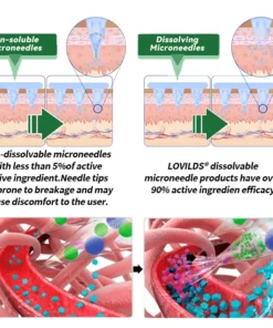 LOVILDS® 𝑴𝒐𝒓𝒊𝒏𝒈𝒂 𝑩𝒆𝒓𝒃𝒆𝒓𝒊𝒏𝒆 10-𝑰𝑵-1 𝑨𝒅𝒗𝒂𝒏𝒄𝒆𝒅 𝑵𝒂𝒏𝒐 𝑴𝒊𝒄𝒓𝒐𝒏𝒆𝒆𝒅𝒍𝒆 𝑷𝒂𝒕𝒄𝒉 (𝐎𝐧𝐜𝐞 𝐃𝐚𝐢𝐥𝐲, 𝐯𝐢𝐬𝐢𝐛𝐥𝐞 𝐜𝐡𝐚𝐧𝐠𝐞𝐬 𝐢𝐧 𝟕 𝐝𝐚𝐲𝐬 𝐎𝐛𝐞𝐬𝐢𝐭𝐲, 𝐃𝐢𝐚𝐛𝐞𝐭𝐞𝐬, 𝐒𝐥𝐞𝐞𝐩 𝐀𝐩𝐧𝐞𝐚, 𝐀𝐧𝐝 𝐉𝐨𝐢𝐧𝐭 𝐈𝐬𝐬𝐮𝐞𝐬