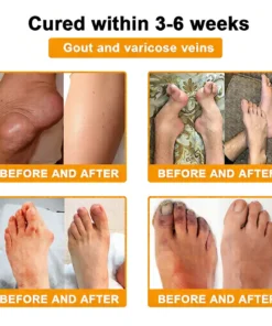 LOVILDS™ Bee Venom Pain-Relief Bone Healing Cream (Specially for older adults)