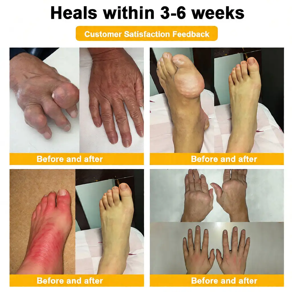 LOVILDS™ Bee Venom Pain-Relief Bone Healing Cream (Specially for older adults)