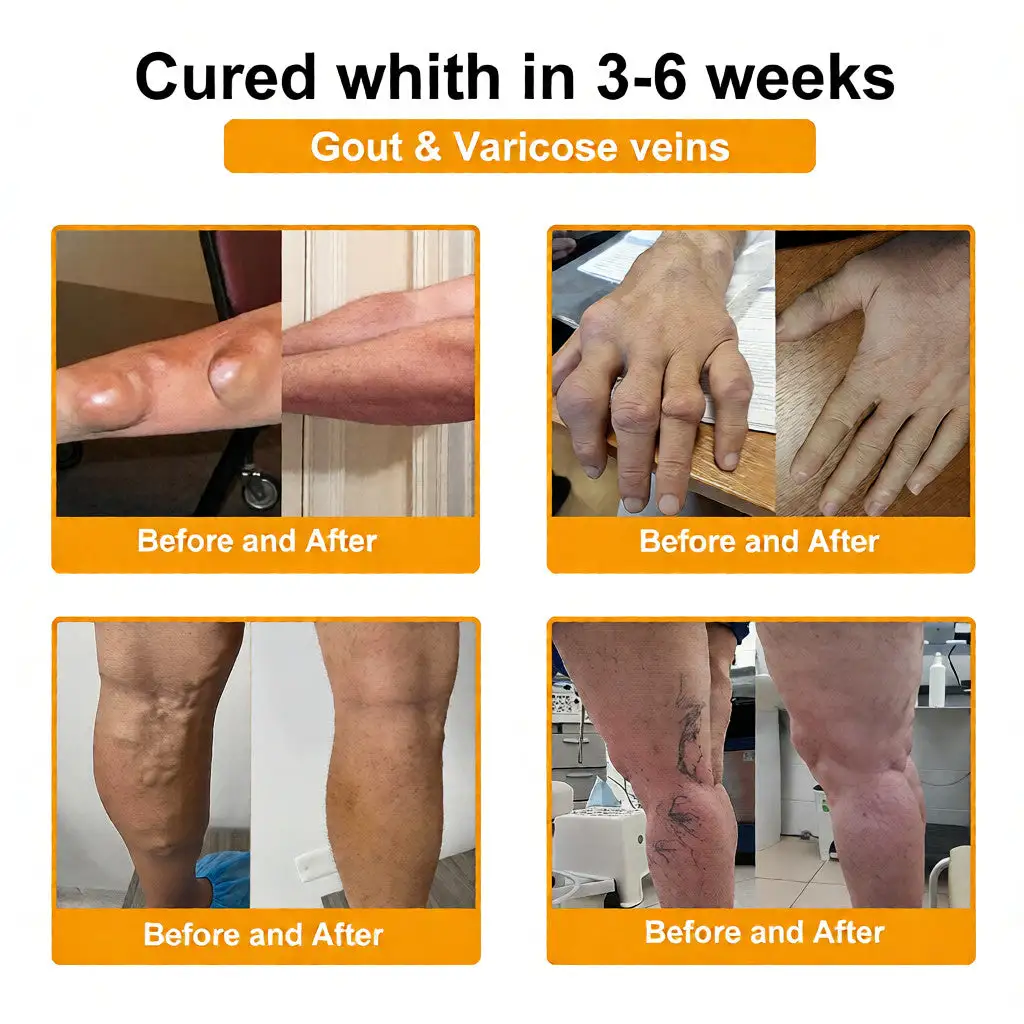 LOVILDS™ Bee Venom Pain-Relief Bone Healing Cream (Specially for older adults)