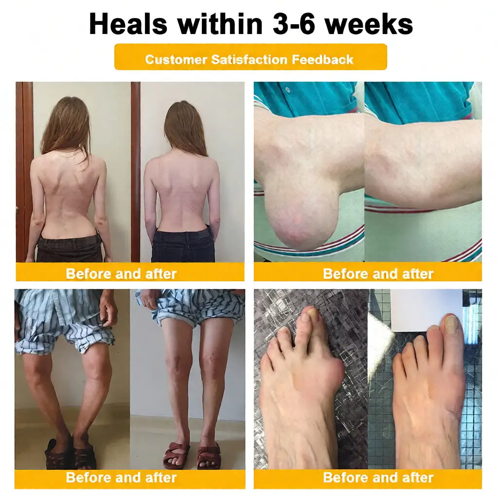 LOVILDS™ Bee Venom Pain-Relief Bone Healing Cream (Specially for older adults)