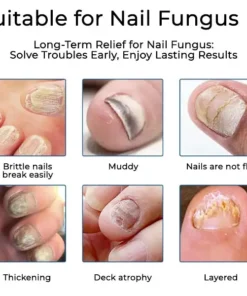 LOVILDS® FUNGAL NAIL PATCHES