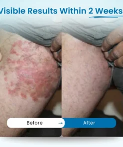 LOVILDS® - Mens GentCare Relief Cream