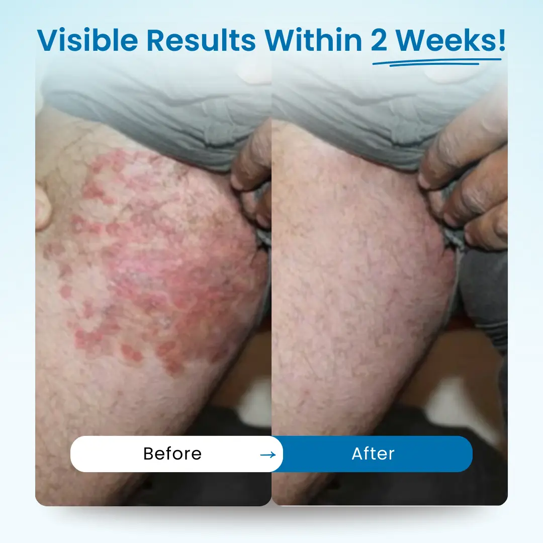 LOVILDS® - Mens GentCare Relief Cream