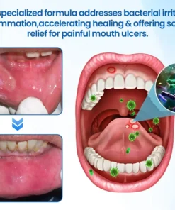 LOVILDS™ NanoHAP Tooth Defense Serum