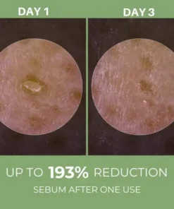 LOVILDS® Rice Peel Ampoule