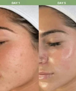 LOVILDS® Rice Peel Ampoule