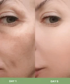 LOVILDS® Rice Peel Ampoule