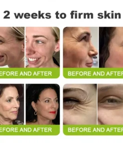 LOVILDS® Skin Tightening Vita-A Retinol Retinol shot Anti-Wrinkle Firming Tightening cream - Last Day Promotion 70 OFF