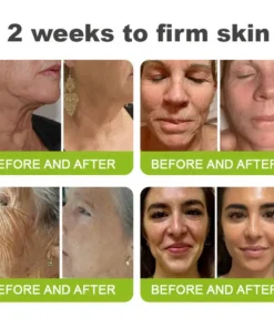 LOVILDS® Skin Tightening Vita-A Retinol Retinol shot Anti-Wrinkle Firming Tightening cream - Last Day Promotion 70 OFF