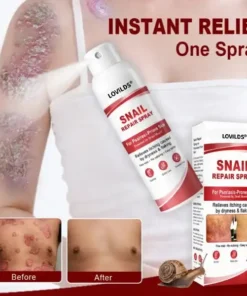 LOVILDS® Snail Repair Spray for Itchy, Flaky Psoriasis Skin