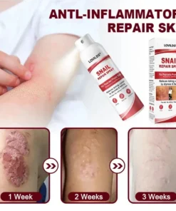 LOVILDS® Snail Repair Spray for Itchy, Flaky Psoriasis Skin