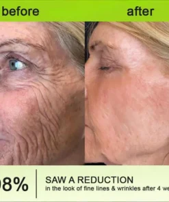 Lovilds® Botin Vita-A Retinol Shot Wrinkle-Lift Tightening cream - Last Day Promotion 70 OFF