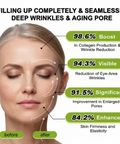 Lovilds® Botin Vita-A Retinol Shot Wrinkle-Lift Tightening cream - Last Day Promotion 70 OFF