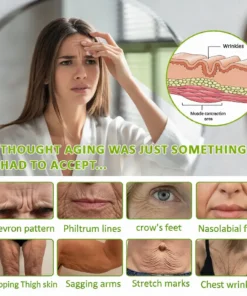 Lovilds® Botin Vita-A Retinol Shot Wrinkle-Lift Tightening cream - Last Day Promotion 70 OFF