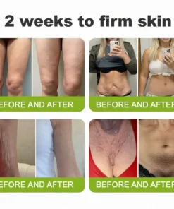 Lovilds® Botin Vita-A Retinol Shot Wrinkle-Lift Tightening cream - Last Day Promotion 70 OFF