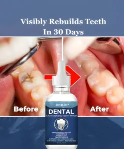 LOVILDS™ Advanced Enamel Repair & Whitening Kit