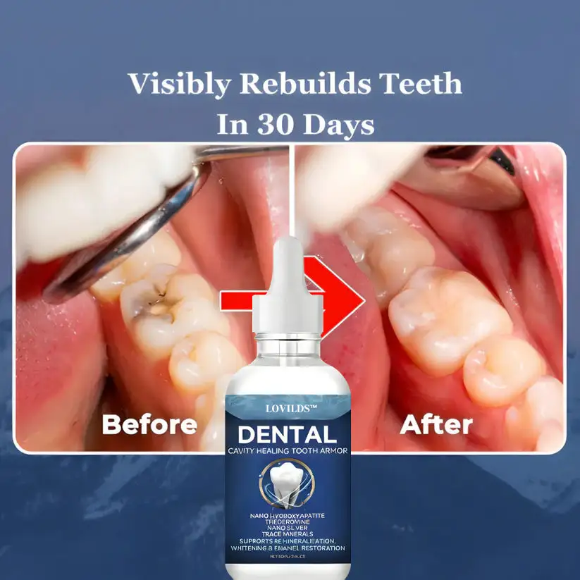 LOVILDS™ Advanced Enamel Repair & Whitening Kit