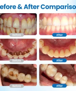 LOVILDS™ Advanced Mineral-Based Tooth Serum