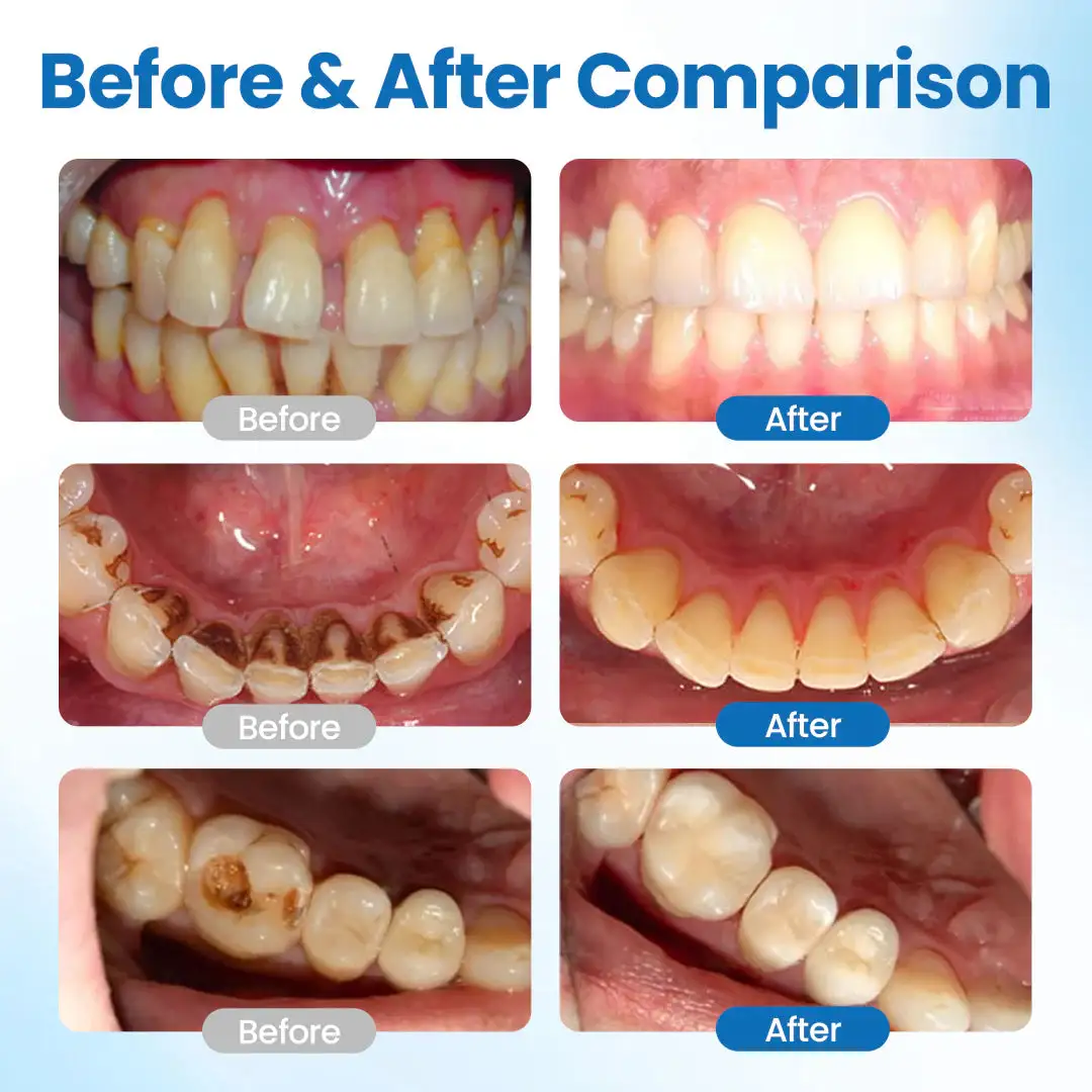 LOVILDS™ Advanced Mineral-Based Tooth Serum