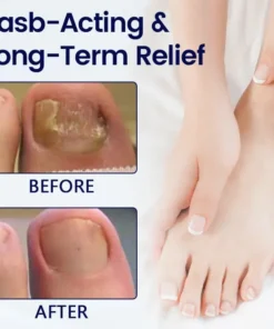 LOVILDS™ Anti-Fungal Nail Repair Patch