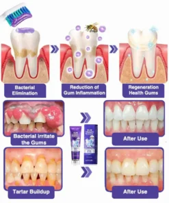 LOVILDS™ Bee Poison Dental Treatment Toothpaste