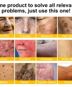 LOVILDS™ Bee Poison Skin Restoration Cream Limited Time 80 OFF