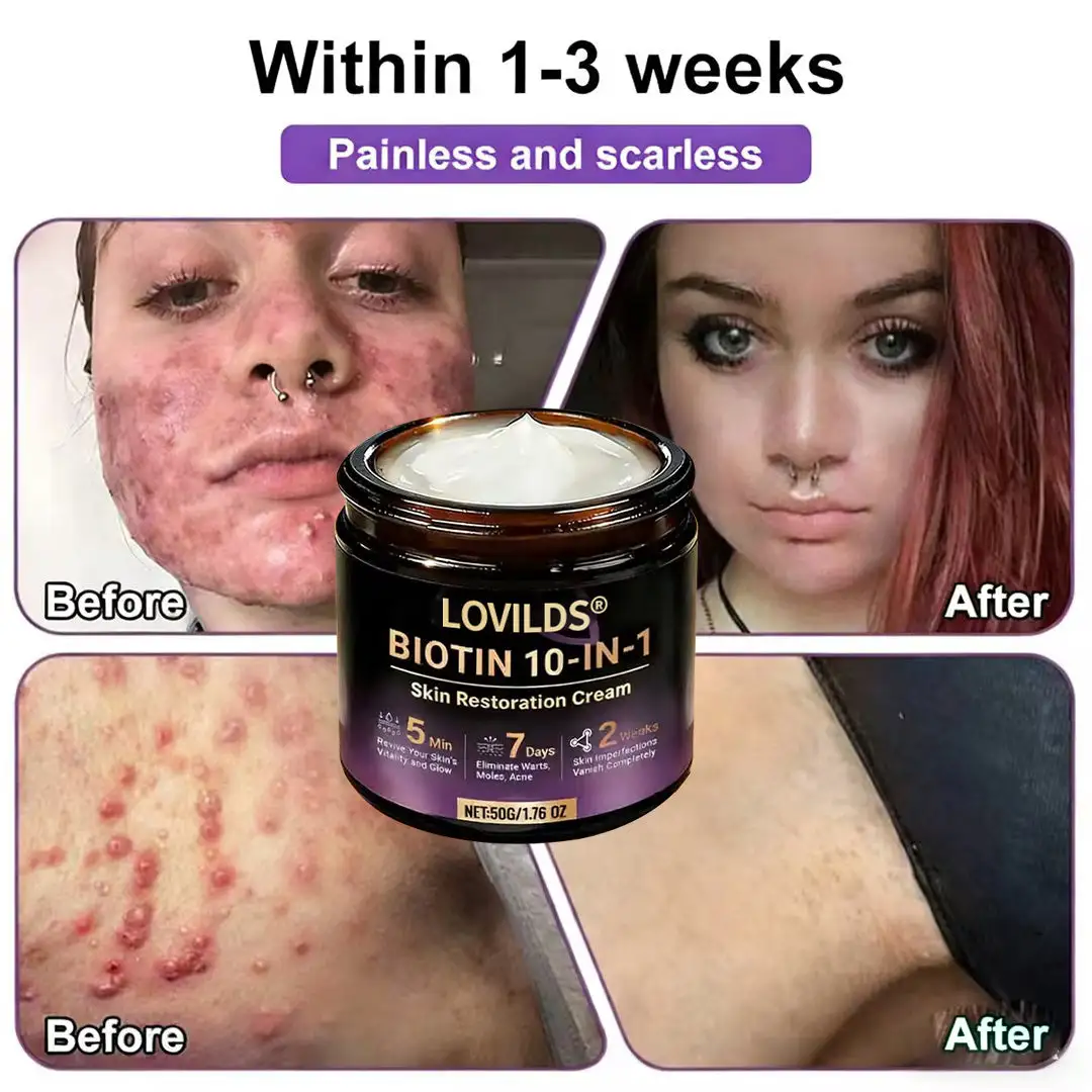 LOVILDS® Biotin 10-in-1 Skin Restoration Cream