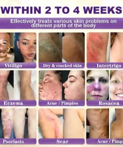 LOVILDS® Biotin 10-in-1 Skin Restoration Cream