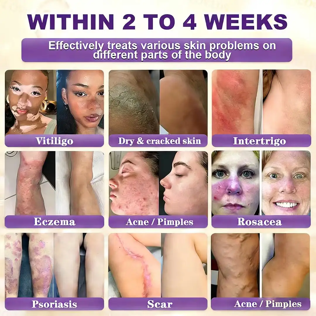 LOVILDS® Biotin 10-in-1 Skin Restoration Cream