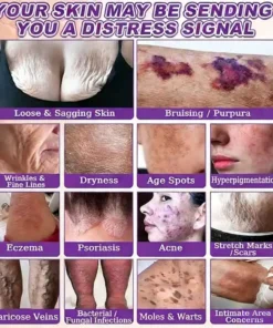 LOVILDS® Biotin 10-in-1 Skin Restoration Cream