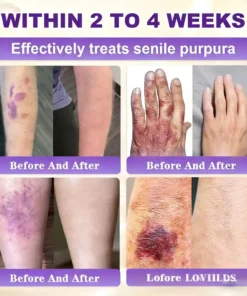 LOVILDS® Biotin 10-in-1 Skin Restoration Cream