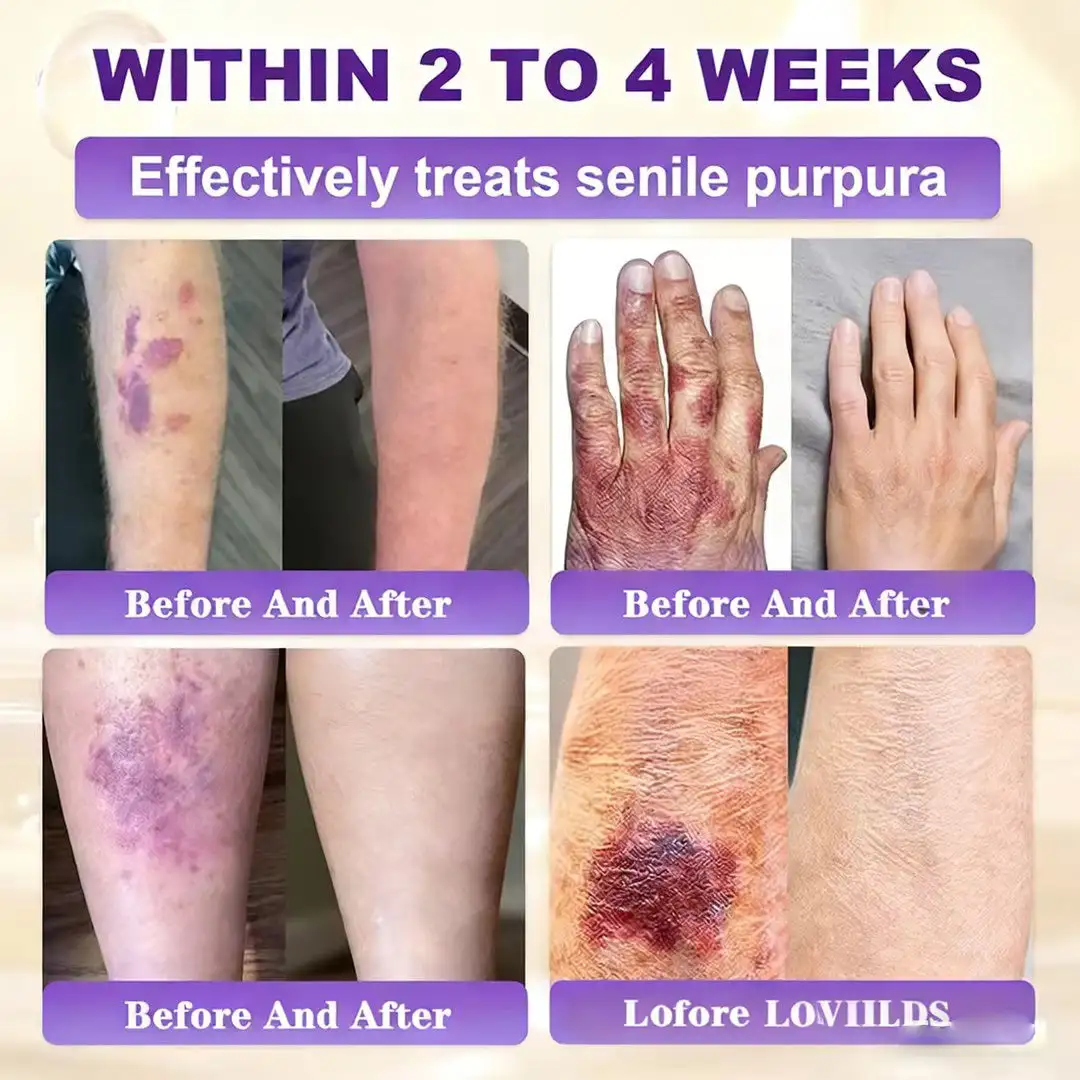 LOVILDS® Biotin 10-in-1 Skin Restoration Cream