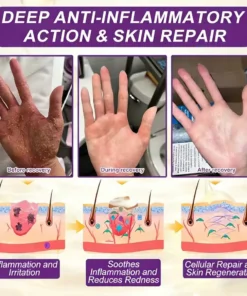 LOVILDS® Biotin 10-in-1 Skin Restoration Cream