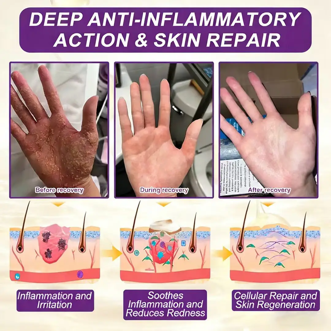 LOVILDS® Biotin 10-in-1 Skin Restoration Cream