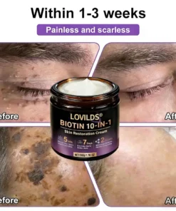 LOVILDS® Biotin 10-in-1 Skin Restoration Cream