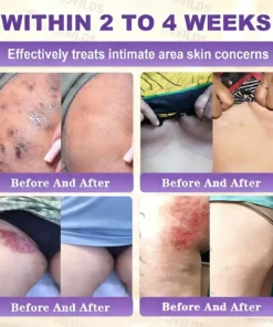 LOVILDS® Biotin 10-in-1 Skin Restoration Cream