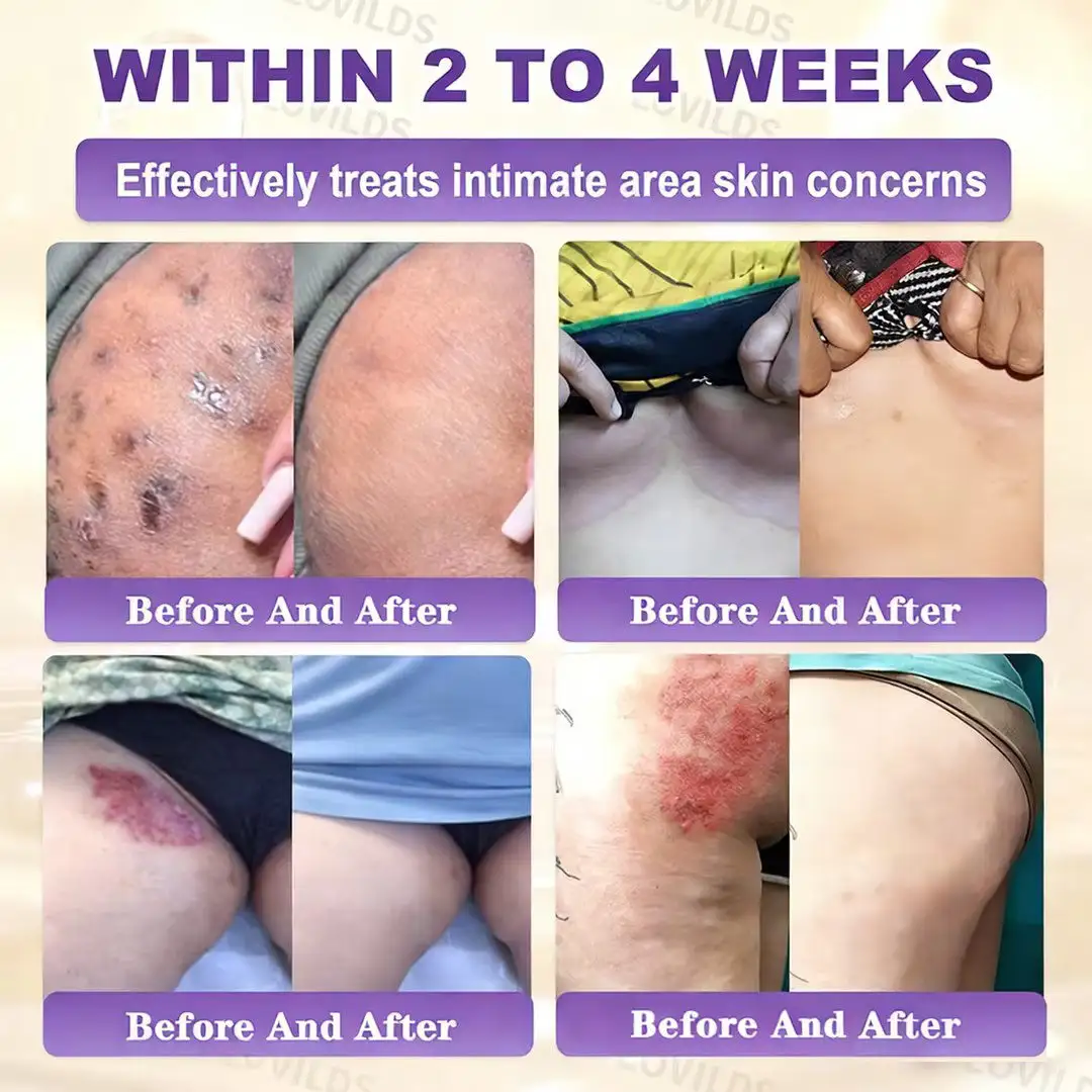 LOVILDS® Biotin 10-in-1 Skin Restoration Cream