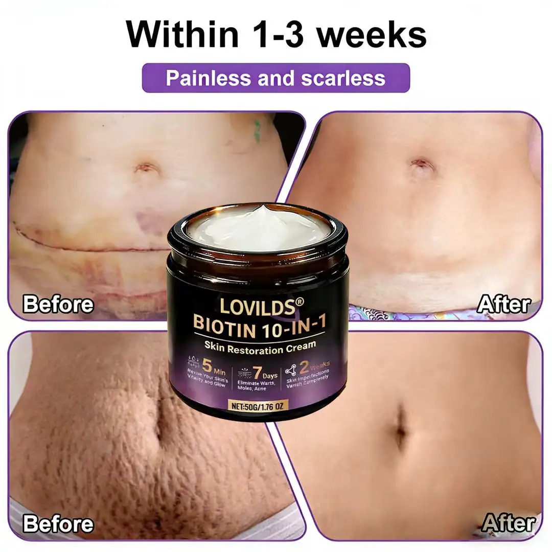 LOVILDS® Biotin 10-in-1 Skin Restoration Cream