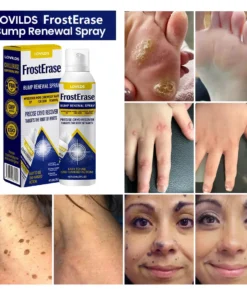 LOVILDS™ FrostErase Bump Renewal Spray
