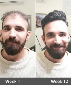 LOVILDS® Highly Effective Biotin & Rosemary Hair Growth Serum